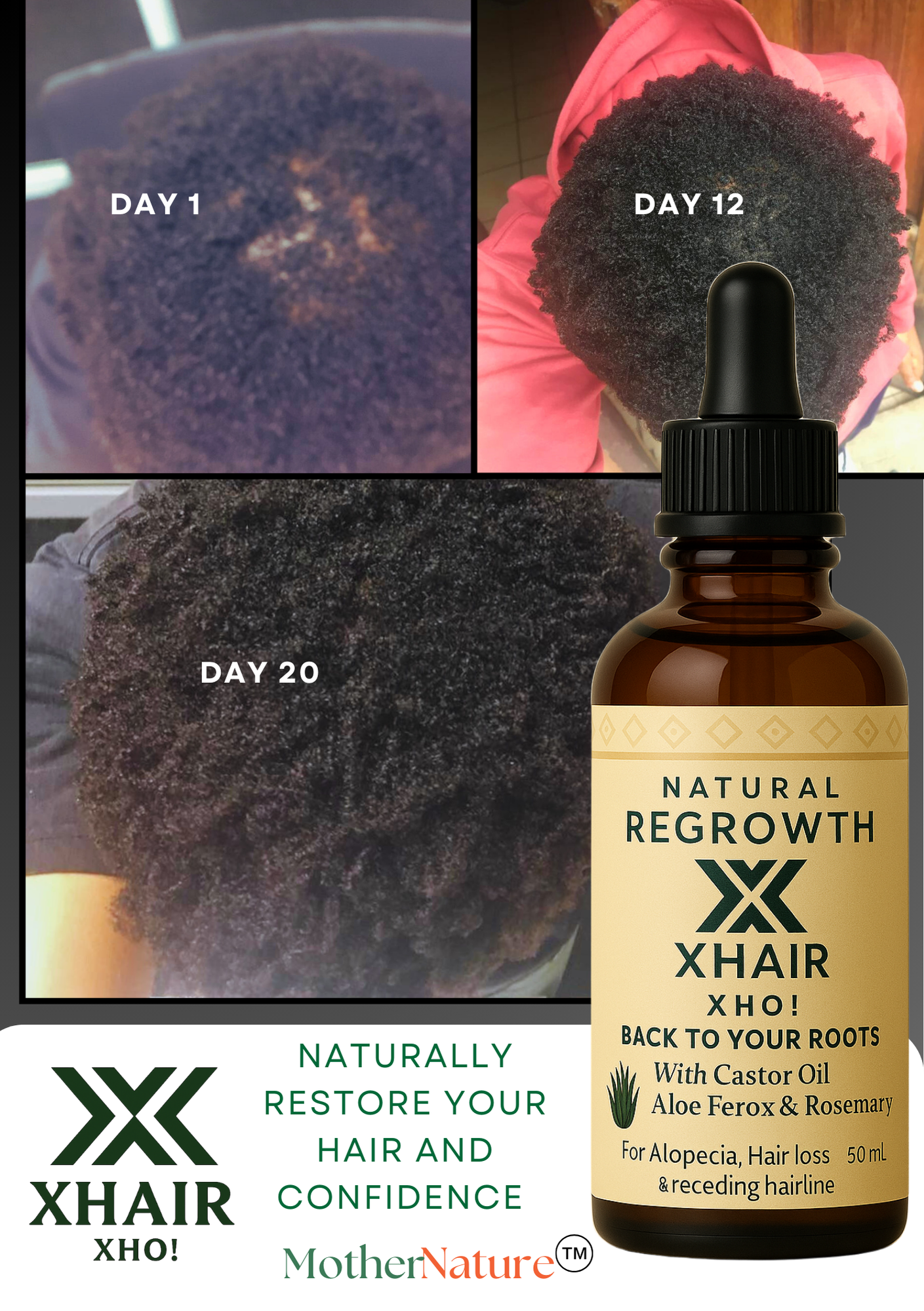 🌿 XHair Oil – Regrow, Strengthen, and Restore 🌿