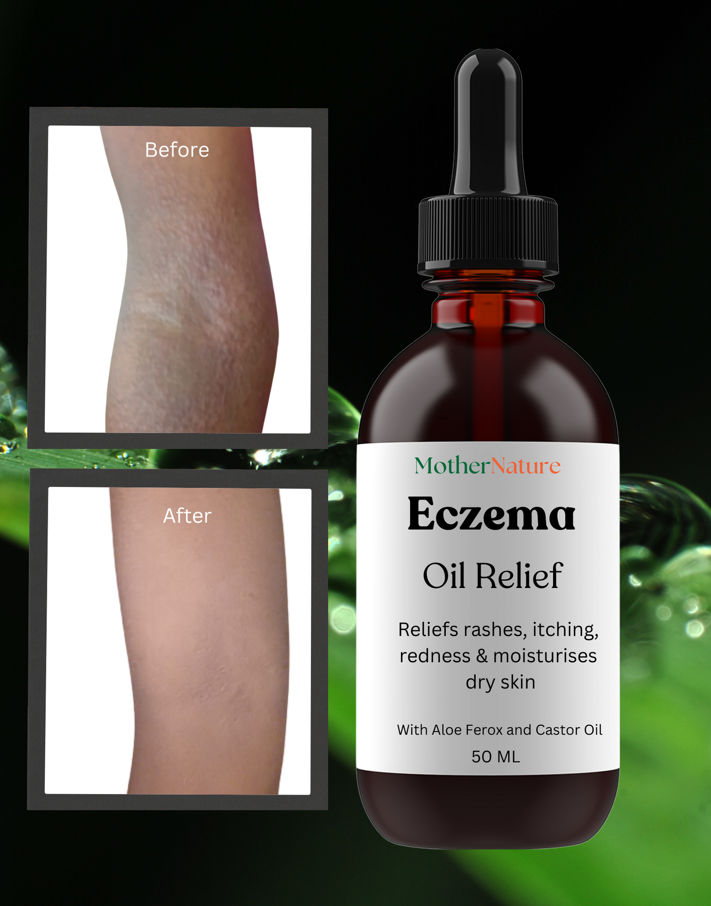 🌿 Natural Eczema Relief Oil – Gentle Healing for All Ages